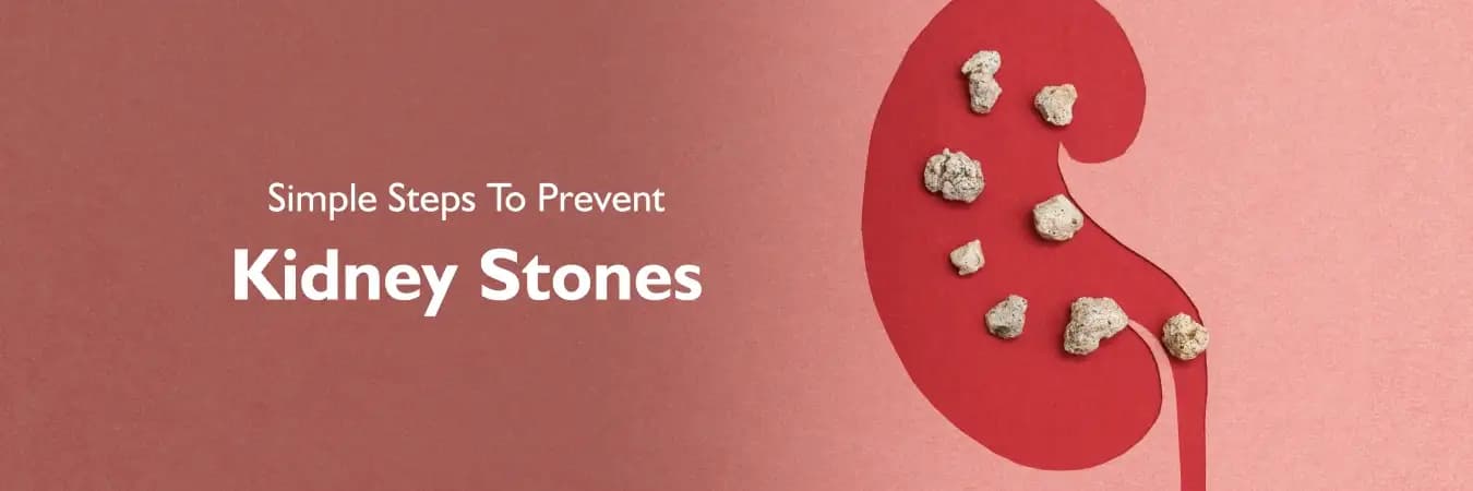 Prevent Kidney Stones Simple Tips - Dr. Vishnu Agrawal Urologist Ajmer