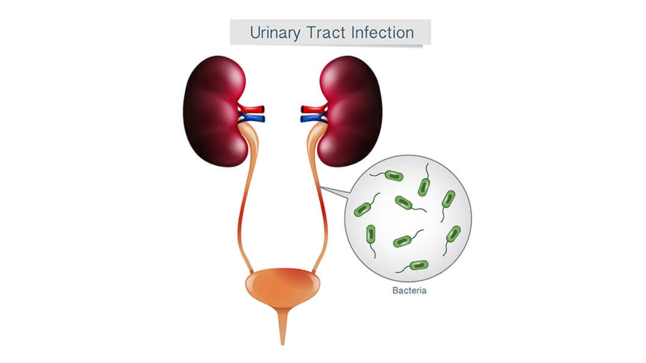 Urinary Disease